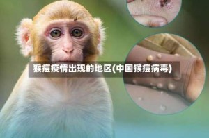 猴痘疫情出现的地区(中国猴痘病毒)