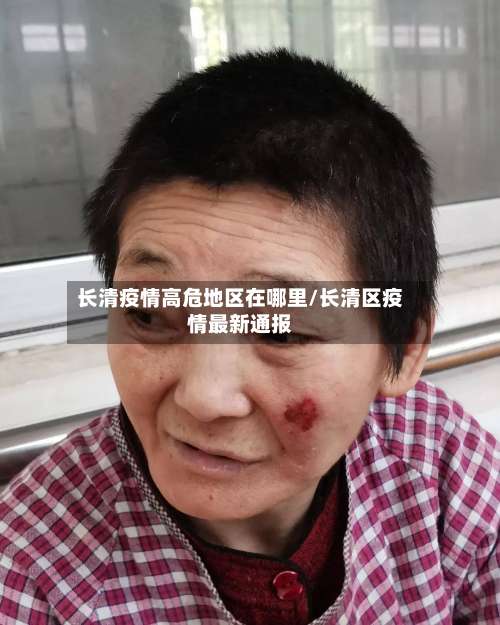 长清疫情高危地区在哪里/长清区疫情最新通报-第2张图片