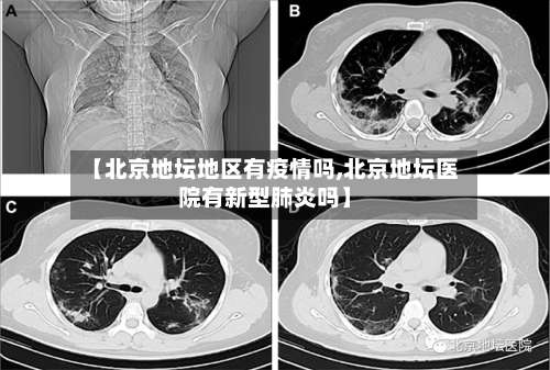 【北京地坛地区有疫情吗,北京地坛医院有新型肺炎吗】-第1张图片
